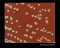neisseria gonorrhoeae